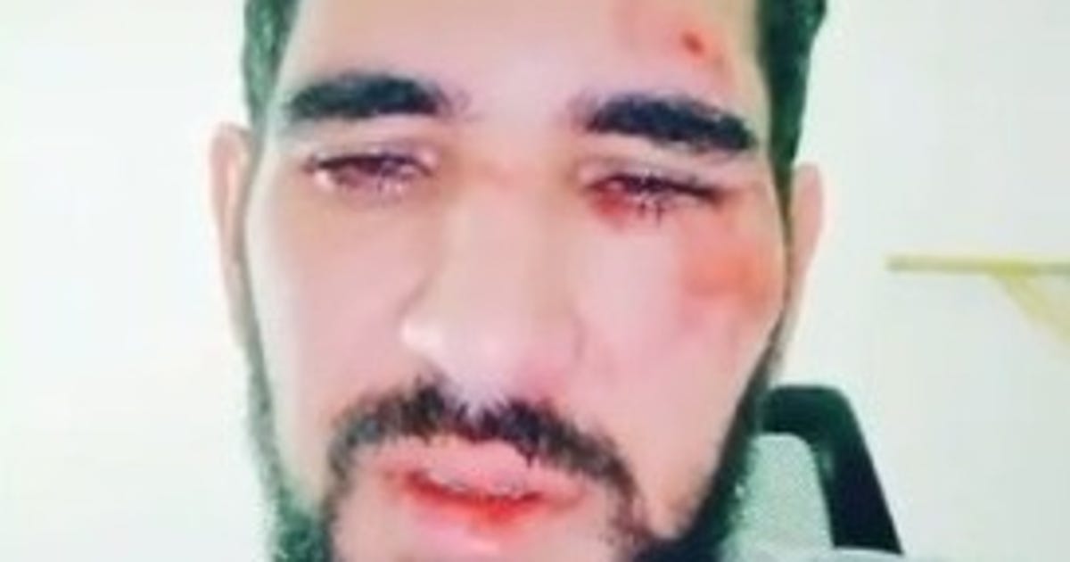 Police Looking Into Possible Hate Crime Against Gay Man From Central Israel - Israel News - Vimarsana News