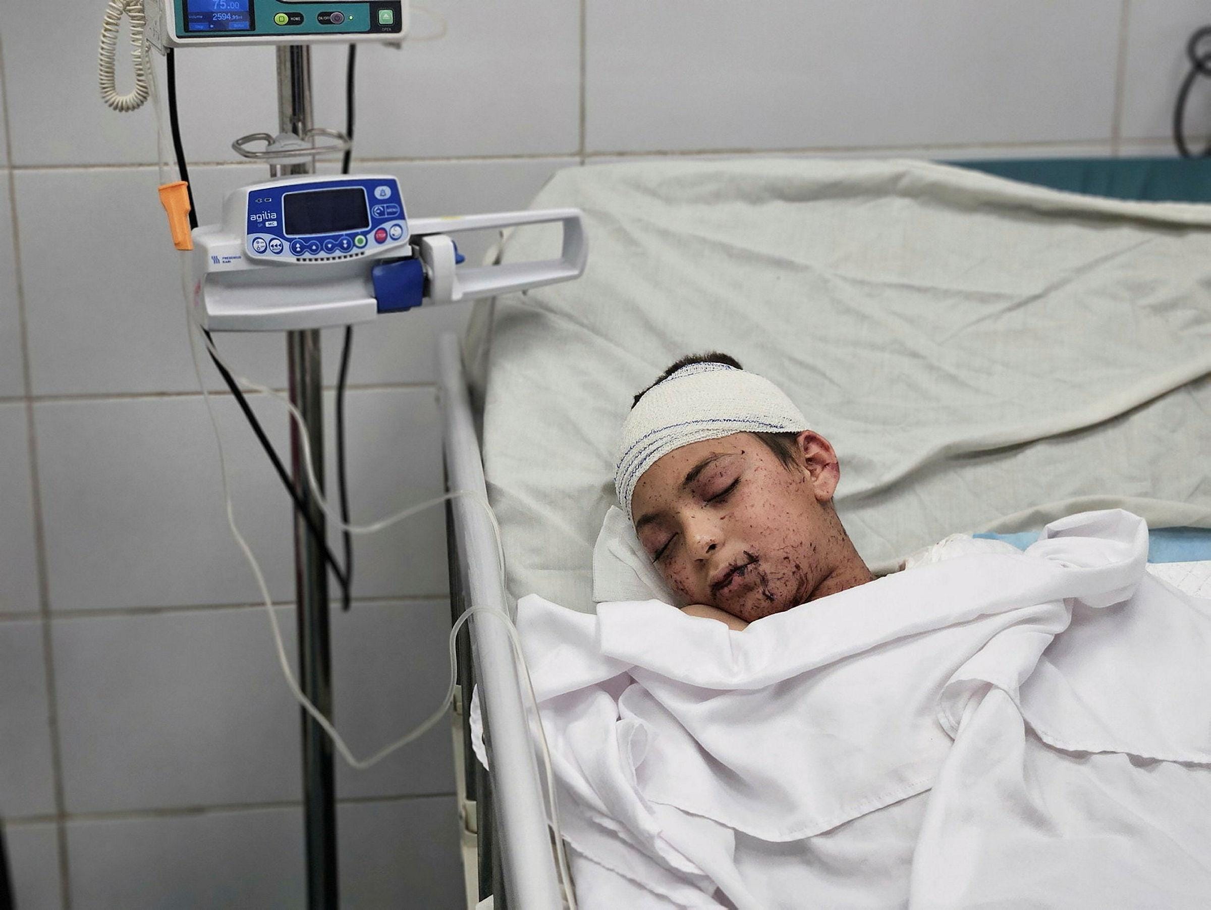 'I want to live in a beautiful place' • 22 wounded children leave Gaza for treatment abroad