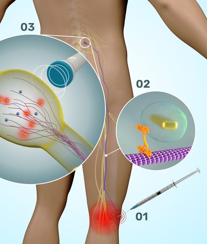 1. Nanoparticle injection
2. Retrograde tracing
3. Ultrasound projection. 1. Nanoparticle injection
2. Retrograde tracing
3. Ultrasound projection
