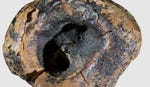 Neanderthal dentist tooth teeth