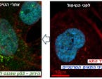 תאי סרטן צוואר הרחם (CaSki). הצטברות p53 בתאים לאחר הוספת EXOp53.