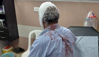 A Palestinian man beaten by settlers in the northern West Bank village of Burqa, east of Ramallah on Saturday.