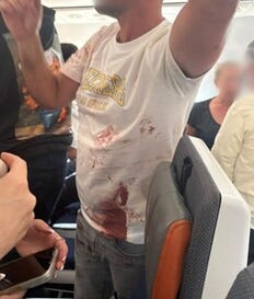 A passenger is seen covered in blood in this image shared on social media.