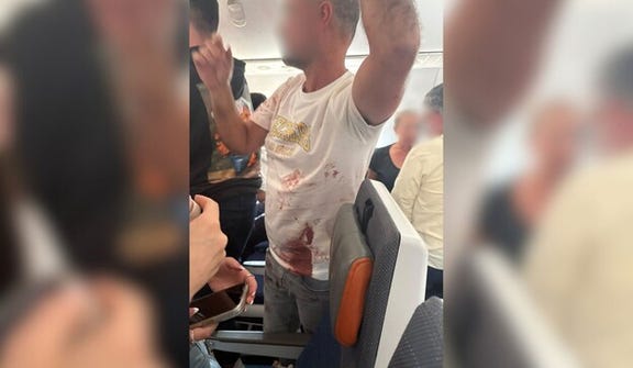 A passenger is seen covered in blood in this image shared on social media.